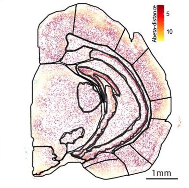 FF_Neuro