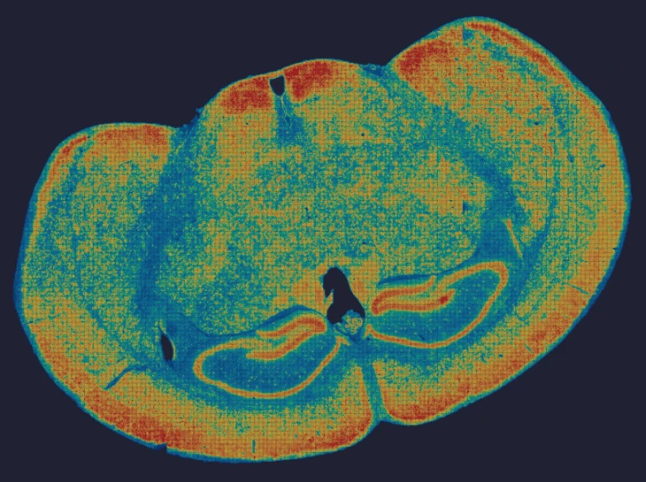 mouse-brain-gene-expression-heatmap