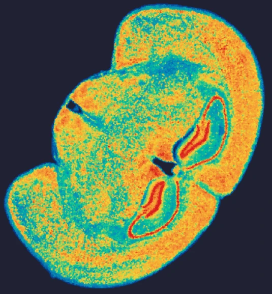 mouse-brain-gene-expression-stereo-seq-omni