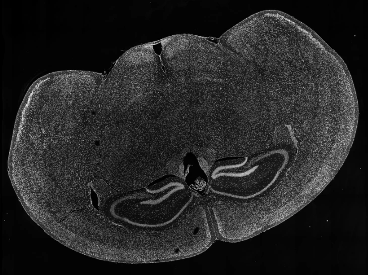 mouse-brain-nucleus-staining-stereo-seq-omni