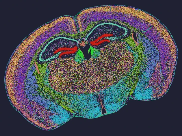 Mouse brain single-cell clustering (cellbin)
Capture area size: 1 cm x 1cm