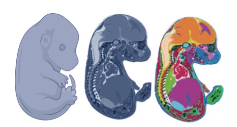 spatial-transcriptomics-histology-molecular-profiling